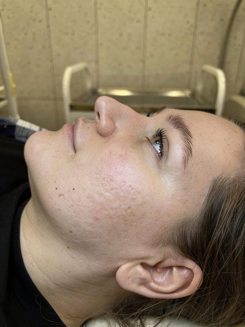 После процедуры