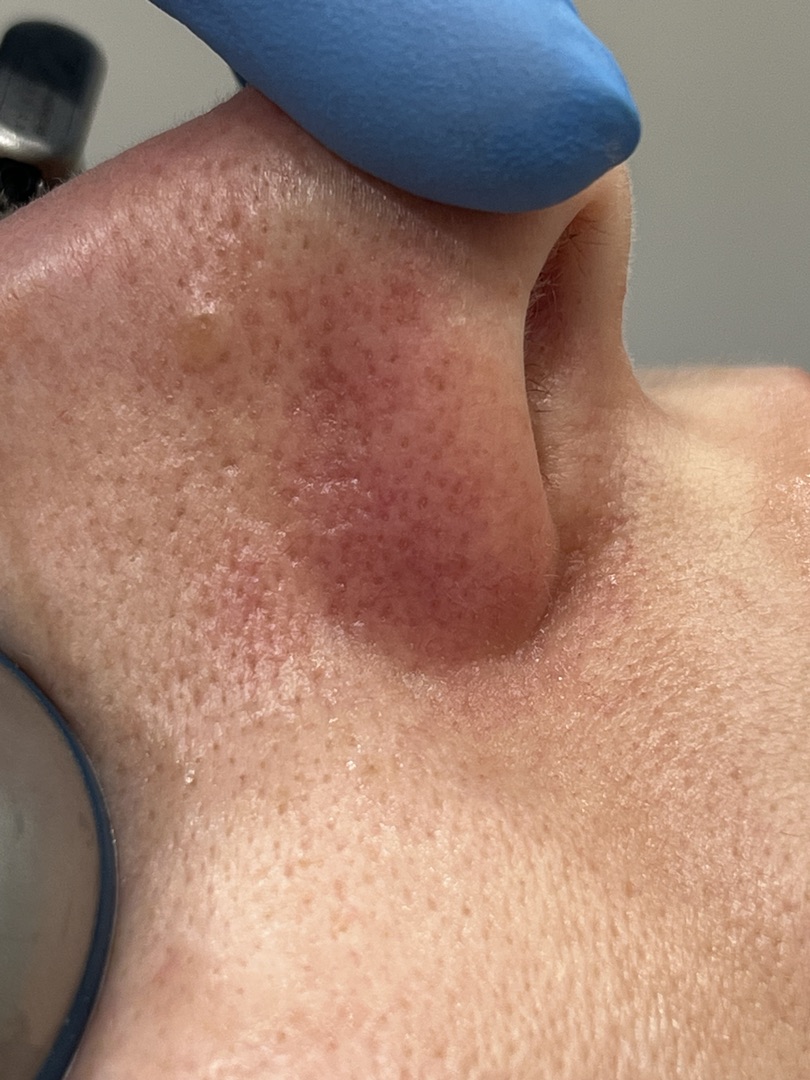 После процедуры