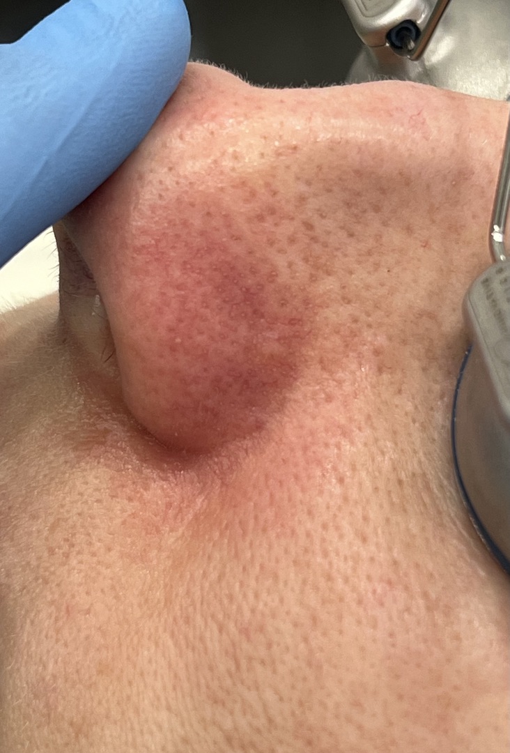 После процедуры