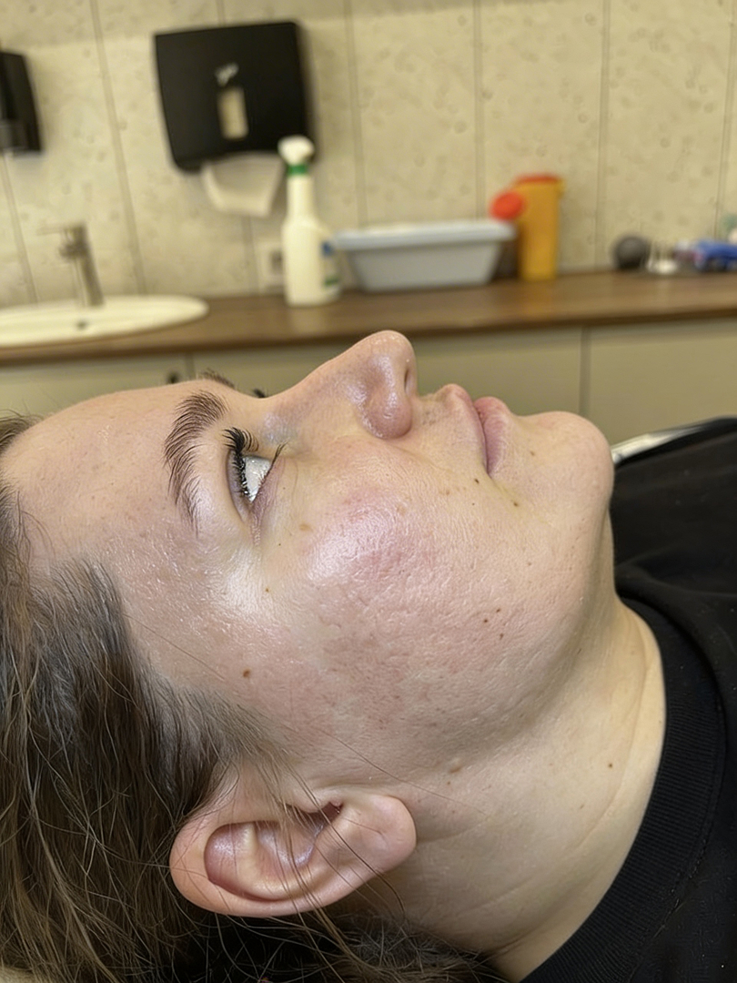 После процедуры