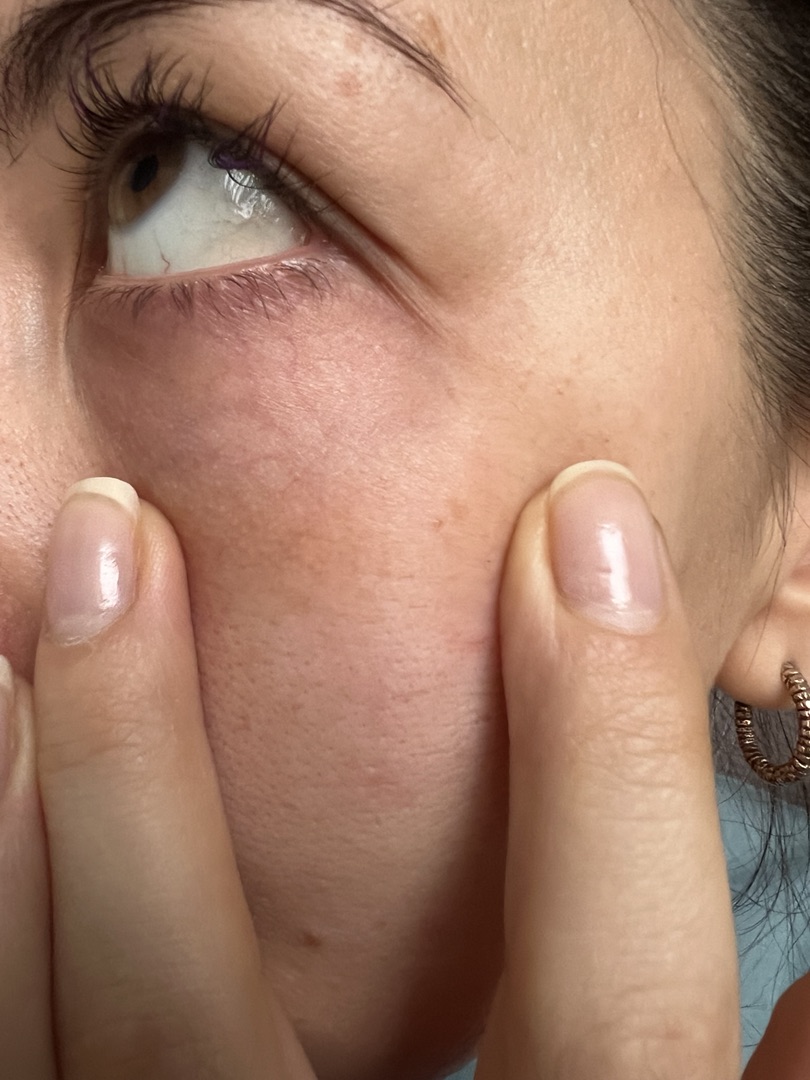 После процедуры